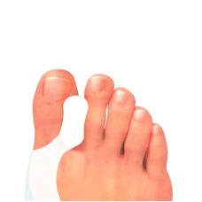 Silicone Bunion Protector Pedag Hallux Toe 277