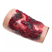 Limb Burn 3rd-4th Degree, PRO-06 - EASY PRACTICE - Advanced Training Status